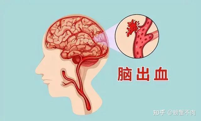 高血压的危害你注意了吗？